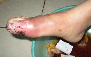 Những căn bệnh cần nói không với đông y